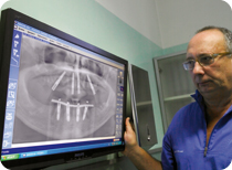 radiografia panoramica denti